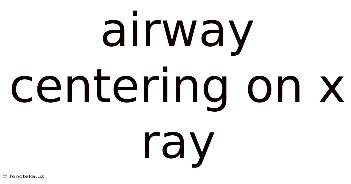 Airway Centering On X Ray