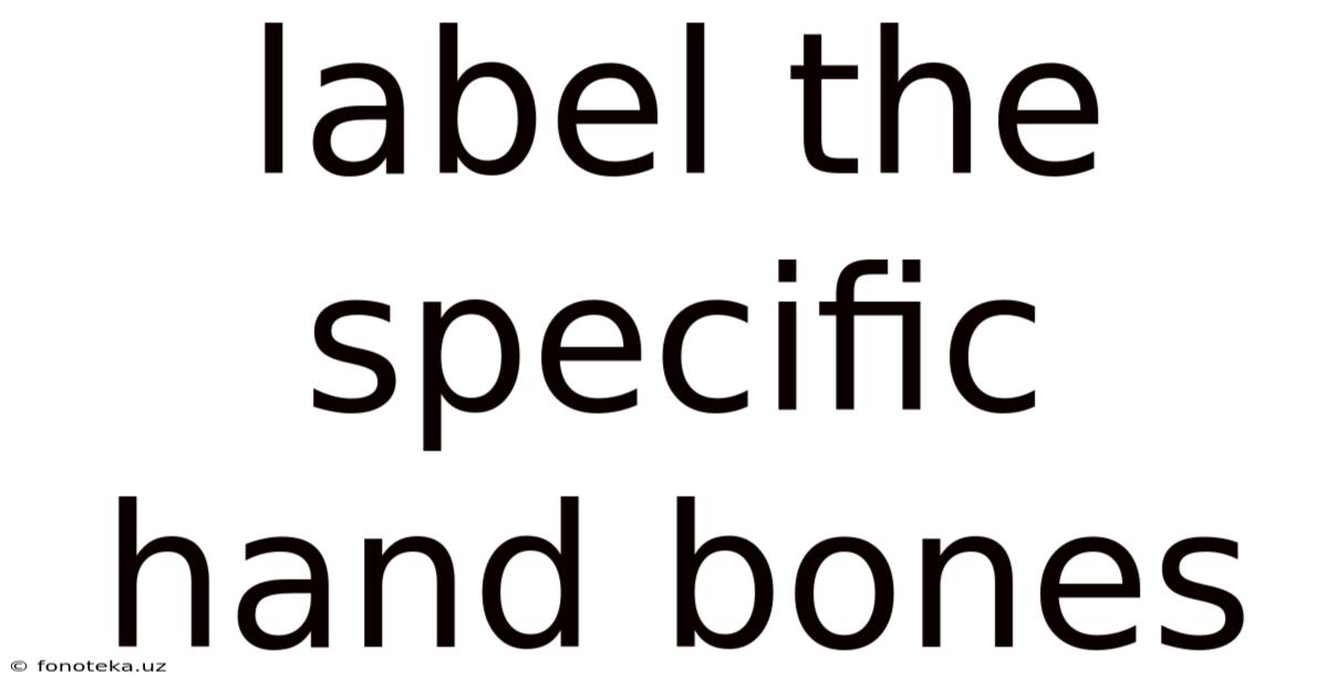 Label The Specific Hand Bones