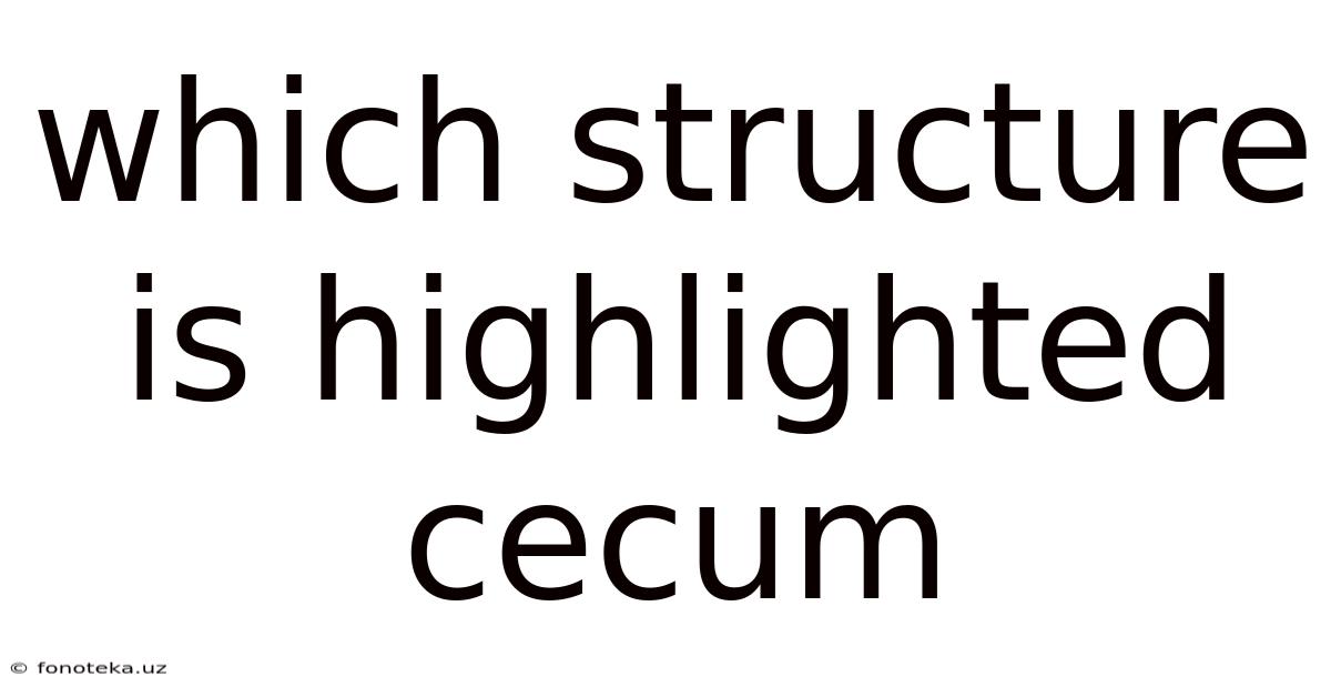 Which Structure Is Highlighted Cecum